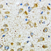 Anti-COG2 Antibody