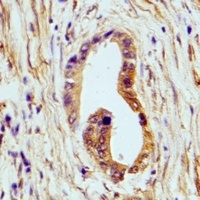 Anti-HSD17B13 Antibody