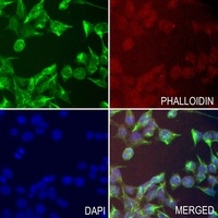 Anti-HSD17B13 Antibody
