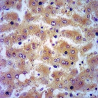 SERPINB1 antibody