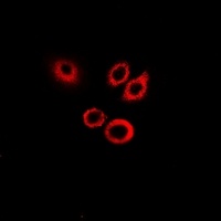 SERPINB1 antibody