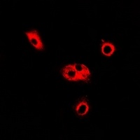 Anti-ADSL Antibody