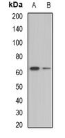 Biotinidase Rabbit Polyclonal Antibody