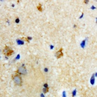 Anti-Biotinidase Antibody