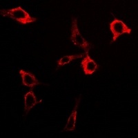 DLAT antibody