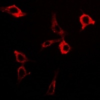 Anti-PDC-E2 Antibody