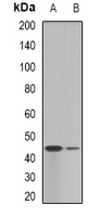 GALT Rabbit Polyclonal Antibody