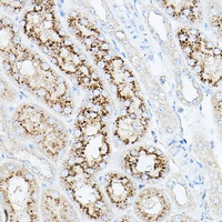 Anti-Neu1 Antibody