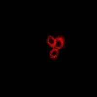 Anti-Neurokinin B Antibody