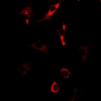 Anti-Nop30 Antibody