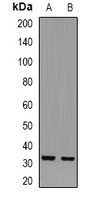 TXNL1 Antibody