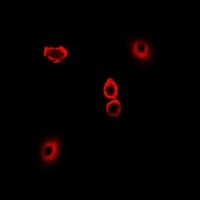 Anti-TXNL1 Antibody