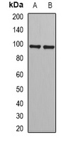 PHF17 Rabbit Polyclonal Antibody
