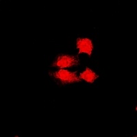 Anti-PHF17 Antibody