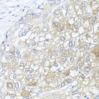 Anti-ASL Antibody