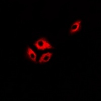 Anti-ASL Antibody