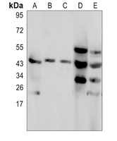 C4BP beta Rabbit Polyclonal Antibody