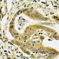 C4BP beta Rabbit Polyclonal Antibody
