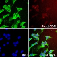 C4BP beta Rabbit Polyclonal Antibody