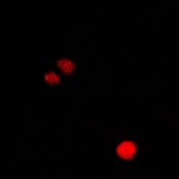 Anti-CLIC1 Antibody