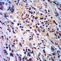 Anti-CAT1 Antibody