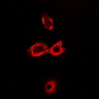 Anti-CAT1 Antibody