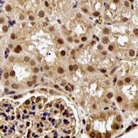Anti-ESE-1 Antibody