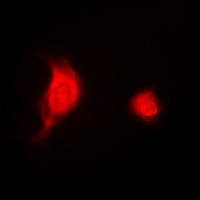 Anti-ESE-1 Antibody
