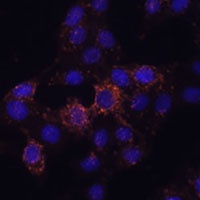 Anti-GRP Antibody