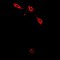 LIMS1 antibody