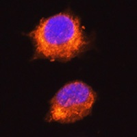 MGAT1 antibody