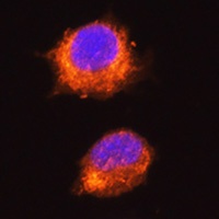 Anti-MGAT1 Antibody
