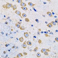 Anti-MsrA Antibody