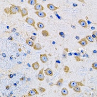 MSRA antibody