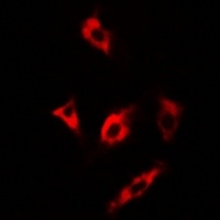 Anti-MsrA Antibody