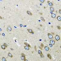 Anti-OGDH Antibody