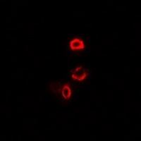 Anti-OGDH Antibody