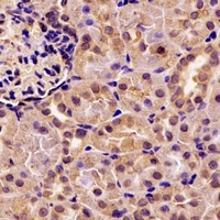Anti-Pancreatic Lipase Antibody