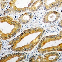 Anti-PPOX Antibody