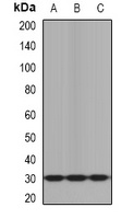 KLK10 Rabbit Polyclonal Antibody