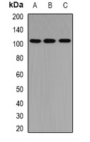 PTP-H1 Rabbit Polyclonal Antibody