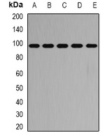PYGB Rabbit Polyclonal Antibody