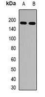 IRBP Rabbit Polyclonal Antibody
