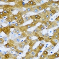 Anti-RPL9 Antibody