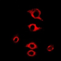 Anti-RPL9 Antibody