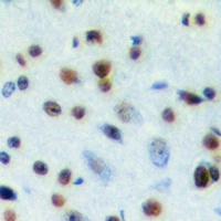 Anti-SNRPA Antibody