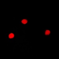 Anti-SNRPA Antibody