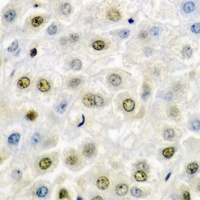 Anti-SSRP1 Antibody