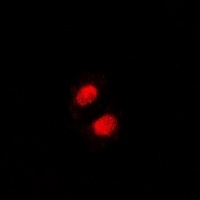 Anti-SSRP1 Antibody