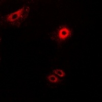 Anti-Secretogranin-2 Antibody